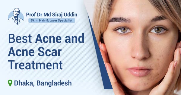 Best acne and acne scar treatment in Dhaka, Bangladesh