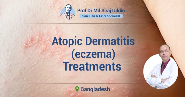 Atopic dermatitis (eczema) treatments in Bangladesh