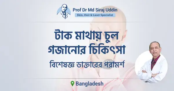 টাক মাথায় চুল গজানোর চিকিৎসা | কারণ ও সমাধান