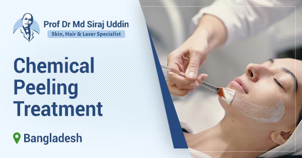 Chemical Peeling Treatment in Bangladesh