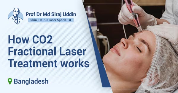 Best CO2 fractional laser in Bangladesh