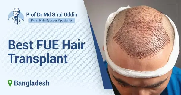 Best FUE Hair Transplant in Bangladesh | Dr. Siraj Uddin