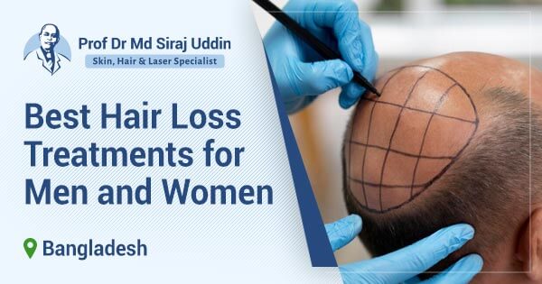 Best hair loss treatments for Men and Women in Bangladesh