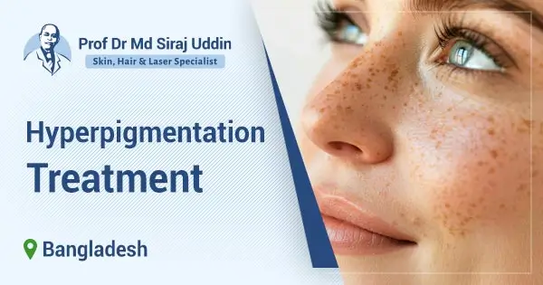 Hyperpigmentation treatment in Bangladesh