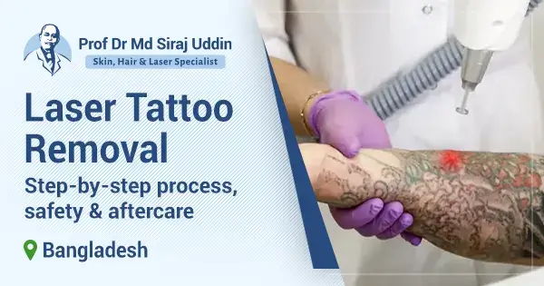 Laser tattoo removal in Bangladesh: Process & safety
