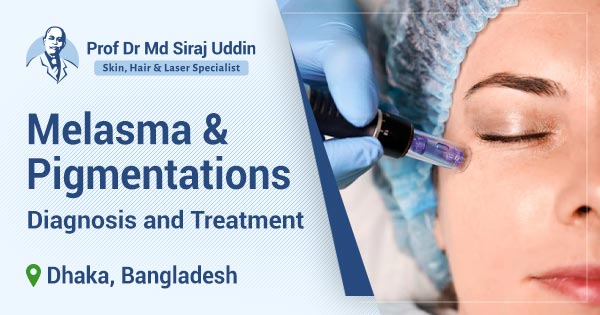 Melasma & Pigmentations: Diagnosis and treatment in Dhaka