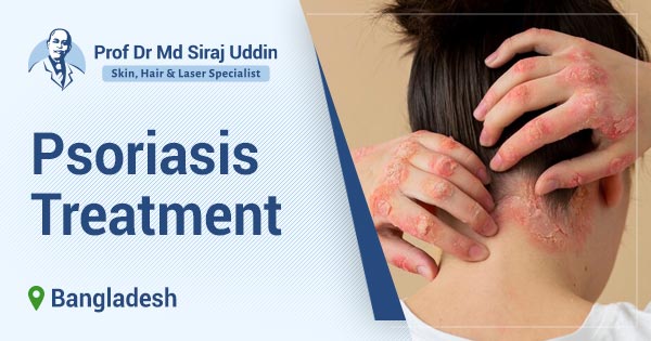 Psoriasis treatment in Bangladesh
