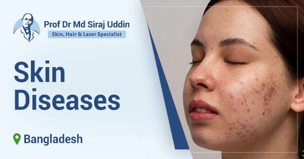 Skin Diseases specialist 