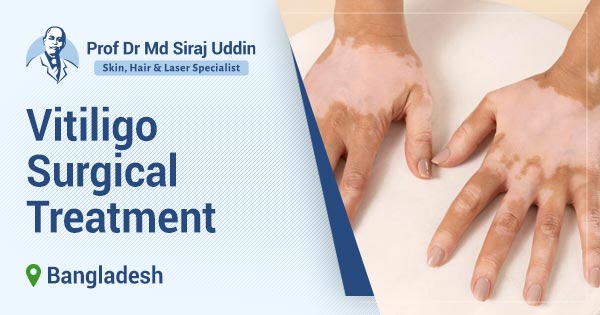 Vitiligo surgical treatment in Bangladesh