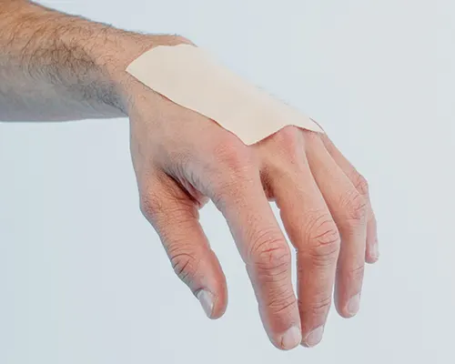 Wet-wrap treatment